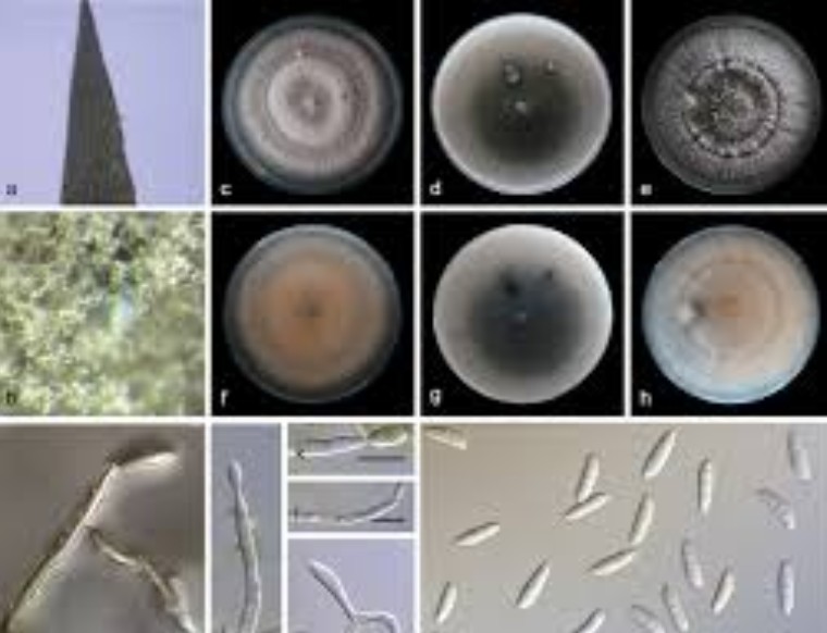 Culture en Boite de pétri et caractérisation au microscope